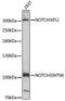 Notch Receptor 3 antibody, 18-949, ProSci, Western Blot image 