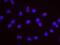 Bromodomain Containing 2 antibody, NBP1-30475, Novus Biologicals, Proximity Ligation Assay image 