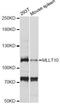 MLLT10 Histone Lysine Methyltransferase DOT1L Cofactor antibody, LS-C749264, Lifespan Biosciences, Western Blot image 