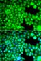 Fatty Acid Binding Protein 3 antibody, LS-C333978, Lifespan Biosciences, Immunofluorescence image 