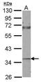 Cellular Communication Network Factor 2 antibody, PA5-32194, Invitrogen Antibodies, Western Blot image 