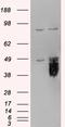 Tissue Factor Pathway Inhibitor antibody, EB05048, Everest Biotech, Western Blot image 