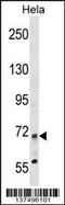 Myotubularin Related Protein 14 antibody, 59-225, ProSci, Western Blot image 