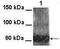 Potassium Voltage-Gated Channel Subfamily Q Member 4 antibody, GTX49069, GeneTex, Western Blot image 