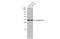 Aquaporin 4 antibody, GTX133151, GeneTex, Western Blot image 