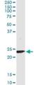 Ubiquitin Conjugating Enzyme E2 T antibody, H00029089-M02, Novus Biologicals, Immunoprecipitation image 