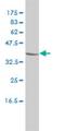 Chitobiase antibody, H00001486-M01, Novus Biologicals, Western Blot image 