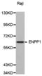 Ectonucleotide Pyrophosphatase/Phosphodiesterase 1 antibody, abx000554, Abbexa, Western Blot image 