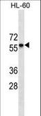 C-C Motif Chemokine Receptor 7 antibody, LS-C159297, Lifespan Biosciences, Western Blot image 