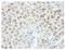 Zinc Finger And BTB Domain Containing 21 antibody, NB100-74656, Novus Biologicals, Immunohistochemistry paraffin image 