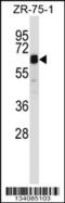 Signal Transducing Adaptor Molecule 2 antibody, 57-437, ProSci, Western Blot image 