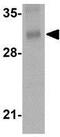 ORAI Calcium Release-Activated Calcium Modulator 3 antibody, GTX17268, GeneTex, Western Blot image 