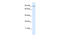 Teashirt Zinc Finger Homeobox 3 antibody, 27-755, ProSci, Western Blot image 