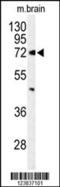 ATP Binding Cassette Subfamily D Member 2 antibody, 64-036, ProSci, Western Blot image 