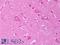 Potassium Voltage-Gated Channel Subfamily J Member 12 antibody, LS-B7459, Lifespan Biosciences, Immunohistochemistry paraffin image 