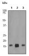 Transthyretin antibody, ab75815, Abcam, Western Blot image 