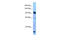 Poly(ADP-Ribose) Glycohydrolase antibody, ARP63555_P050, Aviva Systems Biology, Western Blot image 