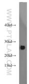 Glutathione S-Transferase Mu 5 antibody, 14502-1-AP, Proteintech Group, Western Blot image 