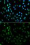 Tissue Factor Pathway Inhibitor antibody, GTX16395, GeneTex, Immunofluorescence image 