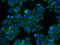 TIMP Metallopeptidase Inhibitor 1 antibody, 16644-1-AP, Proteintech Group, Immunofluorescence image 