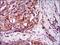 Integrin Linked Kinase antibody, MA5-17099, Invitrogen Antibodies, Immunohistochemistry paraffin image 