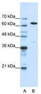 Nuclear RNA Export Factor 1 antibody, TA345955, Origene, Western Blot image 