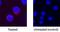 Interleukin 2 antibody, BAF652, R&D Systems, Immunocytochemistry image 