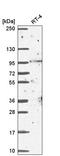 BCAS3 Microtubule Associated Cell Migration Factor antibody, HPA057289, Atlas Antibodies, Western Blot image 