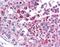 MAGE Family Member A3 antibody, NBP1-56404, Novus Biologicals, Immunohistochemistry paraffin image 