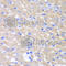 Glycerol-3-Phosphate Acyltransferase, Mitochondrial antibody, A6610, ABclonal Technology, Immunohistochemistry paraffin image 