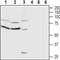 Ciliary Neurotrophic Factor Receptor antibody, PA5-77379, Invitrogen Antibodies, Western Blot image 