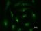 DEAD-Box Helicase 27 antibody, LS-C342435, Lifespan Biosciences, Immunofluorescence image 