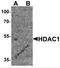 Histone Deacetylase 1 antibody, 7897, ProSci Inc, Western Blot image 