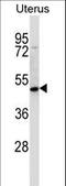 Protein atonal homolog 8 antibody, LS-C156633, Lifespan Biosciences, Western Blot image 