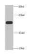 Dynein Axonemal Light Chain 1 antibody, FNab02471, FineTest, Western Blot image 