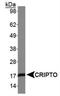 Teratocarcinoma-Derived Growth Factor 1 antibody, NB100-1597, Novus Biologicals, Western Blot image 