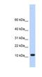 Transmembrane Protein 254 antibody, NBP1-62316, Novus Biologicals, Western Blot image 