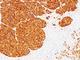 Tyrosinase antibody, NBP2-44684, Novus Biologicals, Immunohistochemistry frozen image 
