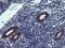 TPD52 Like 3 antibody, NBP2-46012, Novus Biologicals, Immunohistochemistry paraffin image 