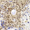PHD Finger Protein 19 antibody, A09028, Boster Biological Technology, Immunohistochemistry paraffin image 