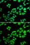 Cullin 1 antibody, GTX53945, GeneTex, Immunocytochemistry image 