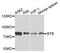 Bruton Tyrosine Kinase antibody, STJ110973, St John