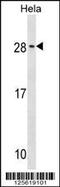 RAB35, Member RAS Oncogene Family antibody, 59-689, ProSci, Western Blot image 