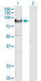 ADAM Metallopeptidase Domain 12 antibody, LS-C198523, Lifespan Biosciences, Western Blot image 