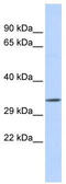 Testis Expressed 264, ER-Phagy Receptor antibody, TA341988, Origene, Western Blot image 