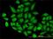 Translocase Of Outer Mitochondrial Membrane 22 antibody, H00056993-M01, Novus Biologicals, Immunocytochemistry image 