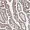 Transmembrane And Immunoglobulin Domain Containing 2 antibody, HPA011081, Atlas Antibodies, Immunohistochemistry frozen image 