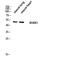 RUNX Family Transcription Factor 1 antibody, STJ95556, St John