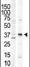 Calcium/Calmodulin Dependent Protein Kinase I antibody, PA5-14032, Invitrogen Antibodies, Western Blot image 