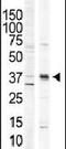 Calcium/calmodulin-dependent protein kinase type 1 antibody, PA5-14032, Invitrogen Antibodies, Western Blot image 